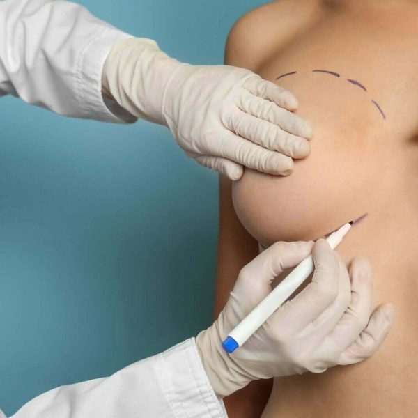 breast reconstruction surgery mexico