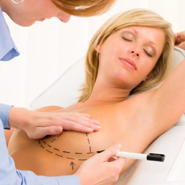 breast augmentation surgery mexico