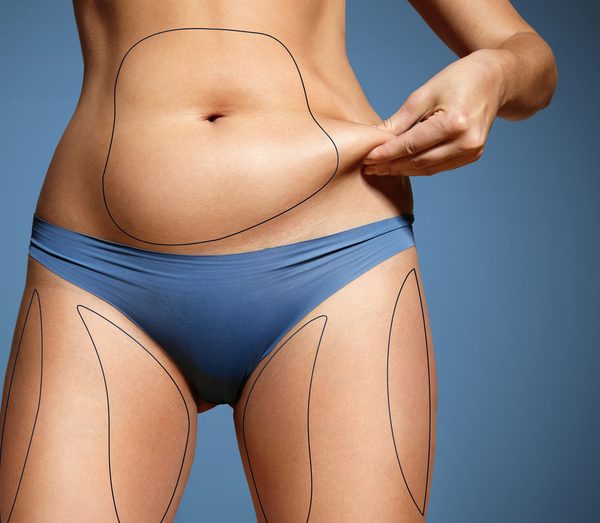 tummy tuck surgery mexico