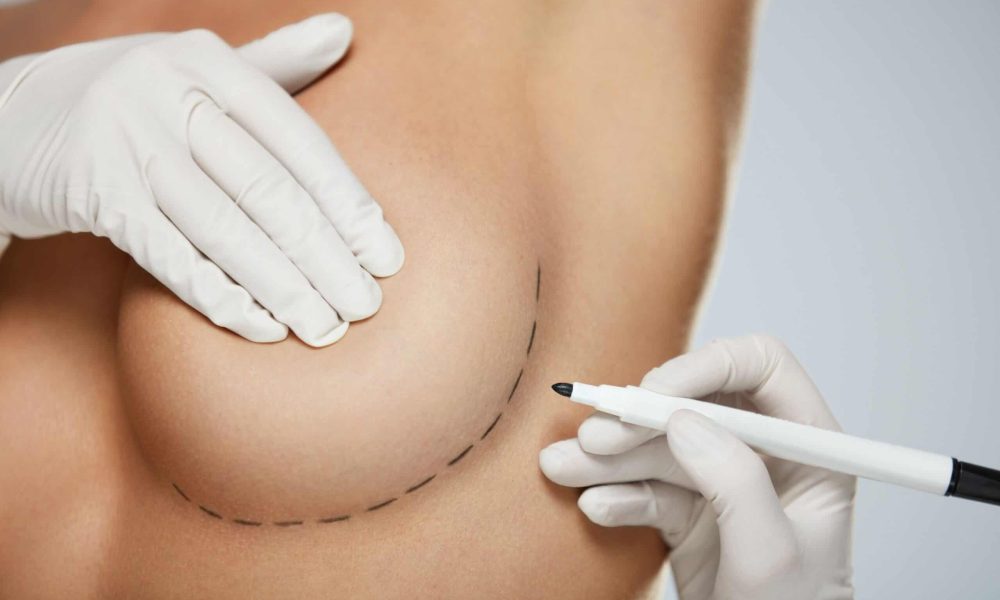 breast reconstruction surgery mexico