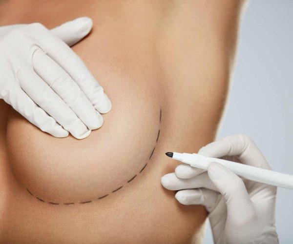 breast reconstruction surgery mexico