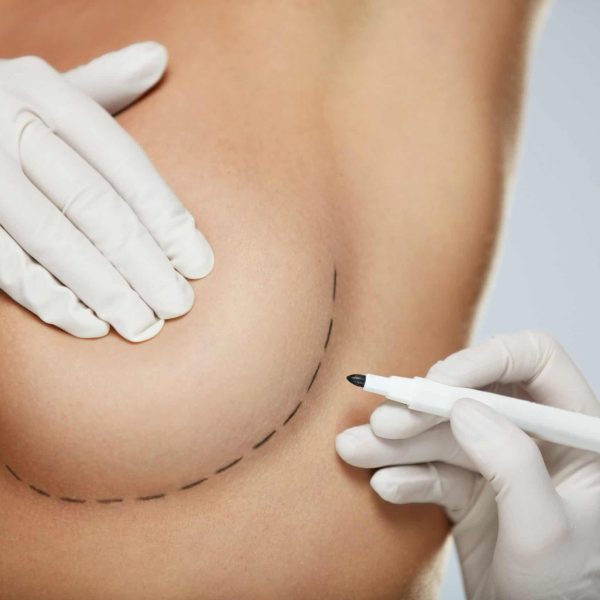 breast reconstruction surgery mexico